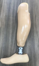 Modular tibial prosthesis, including those with underdevelopment