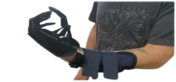 Active hand prosthesis, including partial and partial disarticulation of the hand PR0-22