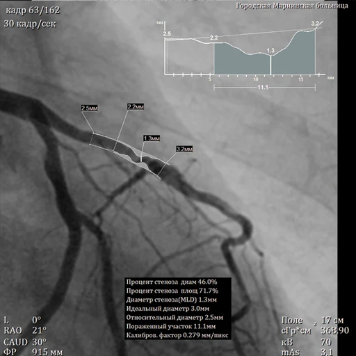 Angiographic X-ray System AKR-"MAXIMA" Model AKR-000-01