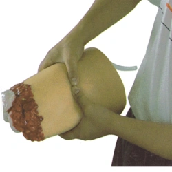 Hip model with amputation injury, H3008/ FA6840