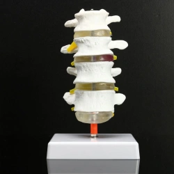 Model of four lumbar vertebrae, 11109-3