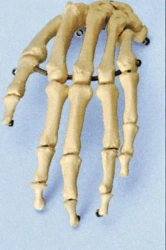 Model of hand bones 11126
