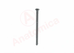 Sponge screw, solid threads