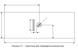 Disposable nonwoven sheet for limb surgery, included in the Disposable Nonwoven Linen Set for Limb Restriction for Surgery