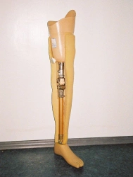 Modular hip prosthesis PN6-72