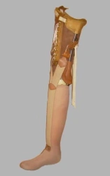Non-modular hip prosthesis, including those with congenital underdevelopment PH6-36