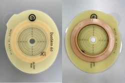 Rehabilitation device for stomical use in colostomies, ileostomies and urostomies: flat plate, convex plate.