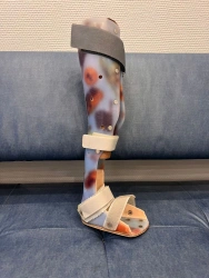 Full leg brace