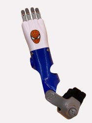 Active forearm prosthesis (traction, transcarpal modification) PR2 CYBI-T