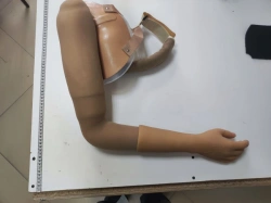 Functional-cosmetic prosthesis after shoulder dislocation