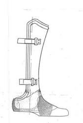 Foot prosthesis