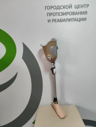 Modular hip prosthesis, including for congenital underdevelopment