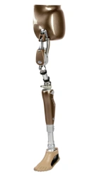 Modular microprocessor-controlled hip dislocation prosthesis