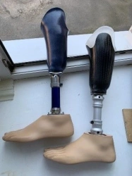 Modular tibial prosthesis