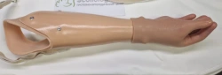 Active (traction) forearm prosthesis