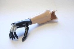 Forearm prosthesis with microprocessor control