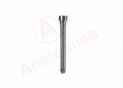 Distal locking screw