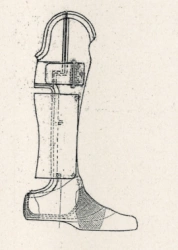 Chopard (Lisfranc) foot prosthesis PN0-06-03