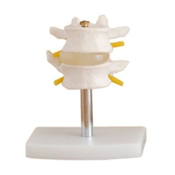 Model of two lumbar vertebrae, 11109-1