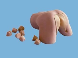 Prostate examination model, CS6252