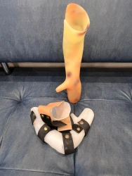 Forearm brace