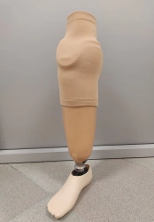 Modular tibial prosthesis, including those with underdevelopment