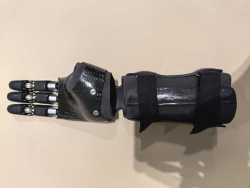 Hand prosthesis with microprocessor control