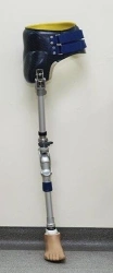 Modular prosthesis for hip dislocation