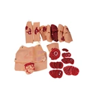 Trauma and injury kit G110-34