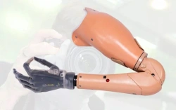 Shoulder prosthesis with microprocessor control system