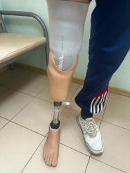 Modular tibia prosthesis, including underdevelopment PN3-OB
