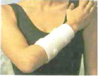 Forearm brace