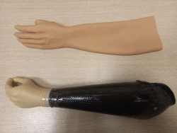 Forearm prosthesis with microprocessor control PR2-MPU.1