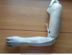 Shoulder prosthesis active (traction) PR4-AT