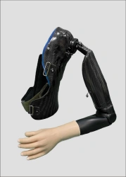 Prosthesis after shoulder dislocation with electromechanical drive and contact control system PR8-23