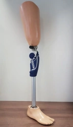 8-07-10 Modular hip prosthesis, including for congenital underdevelopment.