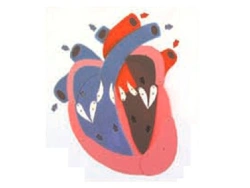 Demonstration model of cardiac systole, diastole and valve opening and closing, 16015