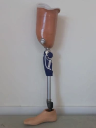 Modular hip prosthesis, including for congenital underdevelopment PN6-M.1
