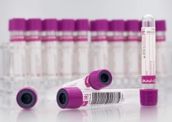 Acti-Fine® vacuum tubes for venous blood sampling with K2EDTA, size 13x75 mm, volume: 2.0 ml