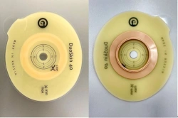 Rehabilitation device for stomical use in colostomies, ileostomies and urostomies: flat plate, convex plate.