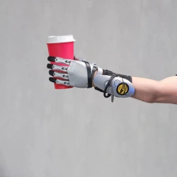 Active (traction) prosthesis of the hand, including separation and partial separation of the hand PR0 CYBI-F