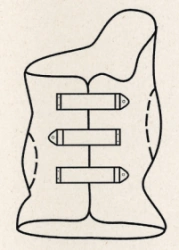 Functional-corrective corset for the thoracolumbar spine KR4-20