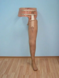 Prosthesis after hip dislocation in the hip joint modular PN8E
