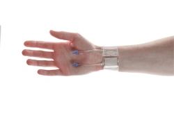 Radial artery compression device NewMan according to TU 32.50.13-001-70849843-2022
