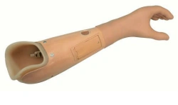 Forearm prosthesis with microprocessor control, PR2-BU