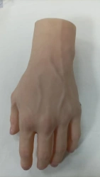 Cosmetic prosthesis of the hand, including partial and partial dislocation of the hand