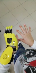 Active (traction) prosthesis of the hand, including separation and partial separation of the hand PR0 CYBI-F