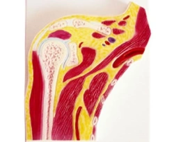 Shoulder profile model, 11202