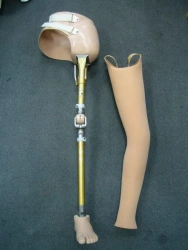 Modular prosthesis for hip dislocation