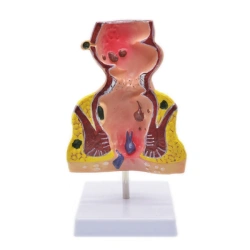 Anatomical model of rectum, item 12007